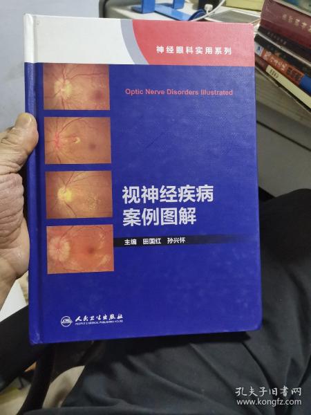 视神经疾病案例图解（神经眼科实用系列）