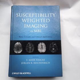 SusceptibilityWeightedImaginginMRI:BasicConceptsandClinicalApplications磁共振成像的研究