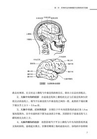 经颅重复针刺刺激疗法