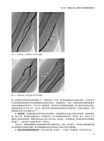 【全新正版，假一罚四】冠心病介入治疗解码9787117326568黄浙勇，葛均波