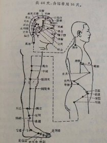 （打折处理，购百元再赠书）特殊时期68年版《针灸临床取穴图解》版本少见存世量少