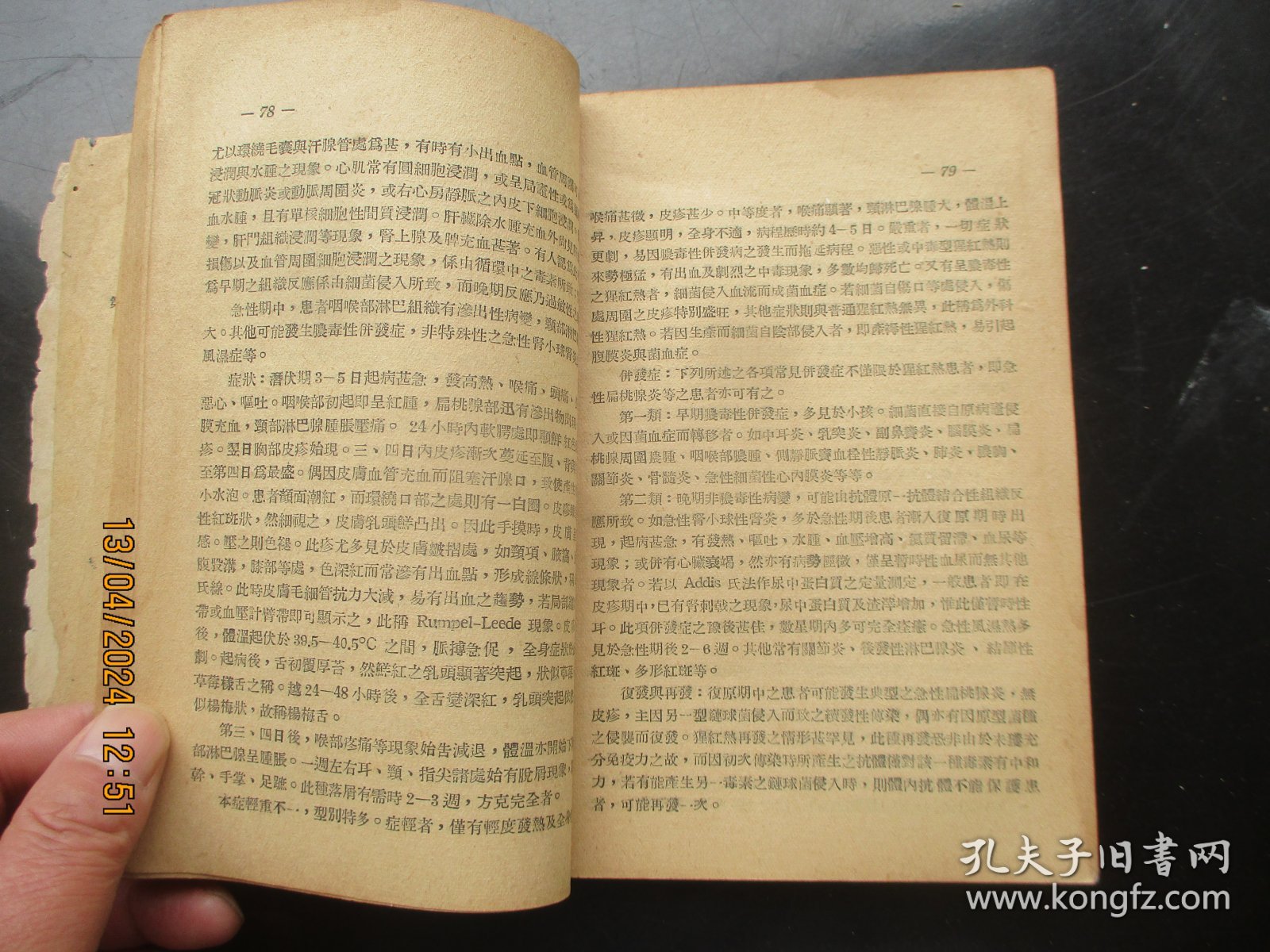 中医平装书《传染病防治学》1952年，1册全，东北防疫委员会编，品好以图为准。