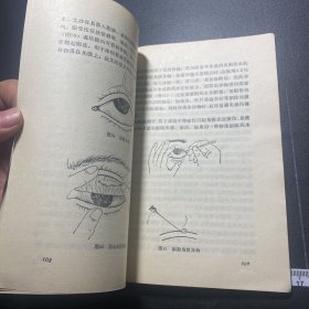 保护儿童的眼睛