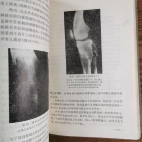 精装    关节  成形术。骨科医学资料   国外作者。