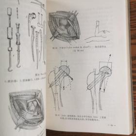 精装    关节  成形术。骨科医学资料   国外作者。