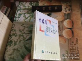 白癜风诊断与治疗