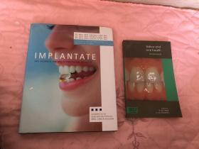 implantate（两本本关于牙科的书）两本合售安德烈亚斯·荣格，MSc·托马斯·荣格，MSc·阿希姆·希珀，MSC，是种植牙科医生 植骨 为感兴趣的患者所写的专业书籍 荣格医生和同事的牙科诊所