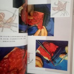 外科手术图解 胃肠手术分册