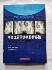 吻合血管的游离腓骨移植治疗股骨头坏死