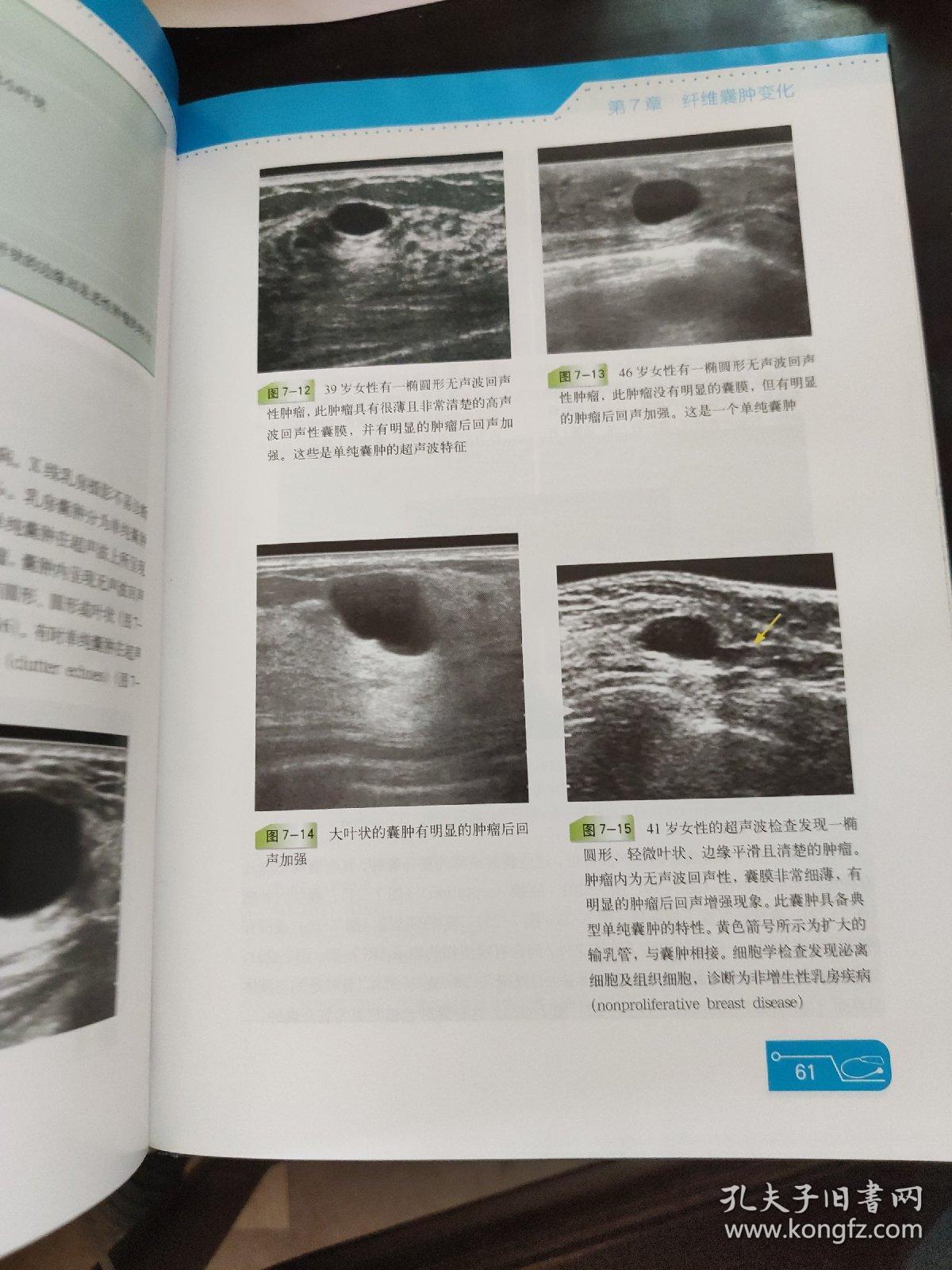 实用乳腺超声波：技术判读鉴别诊断
