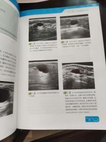 实用乳腺超声波：技术判读鉴别诊断