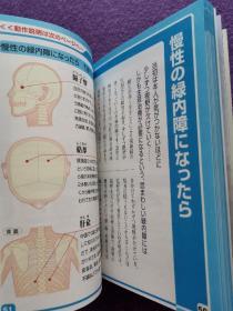 予防と健康のッボ気功·第10卷:目と耳、低血压——视力减退、耳の症状、冷え症（彩印图文）