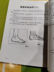 穴宝实用操作九法八十一绝   （ 指法和中医针灸治疗病症 ）