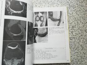 膝关节磁共振诊断（第2版）  精装本