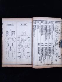 《校正幼科三种》民国三年上海锦章图书局书局石印，一函四册全，含《痘疹金镜録》四卷二册全，《幼科铁镜》上下一册合订全，《推拿广意》上中下一册合订全，小儿推拿按摩著作，图文并茂，单本尺寸约20/13，品相如图！