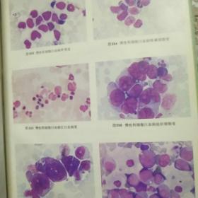临床细胞学图谱 （内有彩色图谱 1984年一版一印 精装16开本）