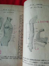 针灸学（江苏省中医学校针灸学科教研组编著），品弱仔细看图。后面缺少一页。59年二版四印。