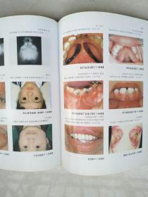 彩图临床口腔外科学