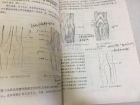 骨科手术学讲义（上下全两册合售）书中有画线注释部分.