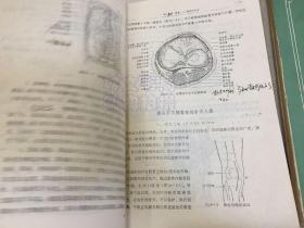 骨科手术学讲义（上下全两册合售）书中有画线注释部分.