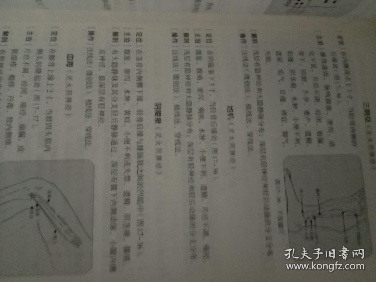 点击查看原图 中国埋线疗法大全(包邮)