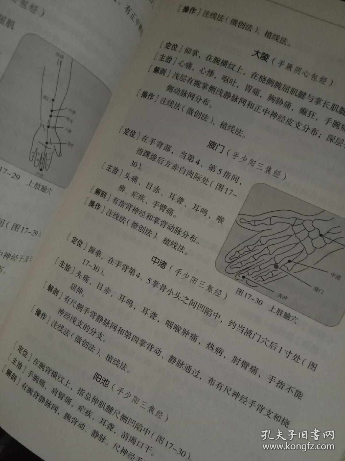 点击查看原图 中国埋线疗法大全(包邮)