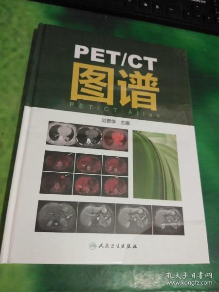 PET/CT图谱