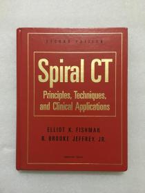 Spiral CT