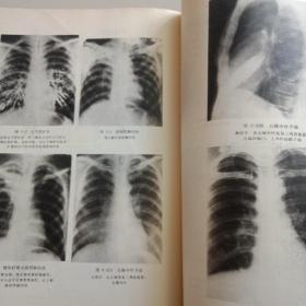 内科疾病签别诊断学内科疾病签别诊断学(内有毛主席语录和医学图片)