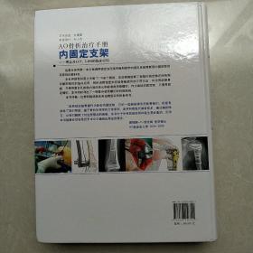 内固定支架：理念及LCP、LISS的临床应用