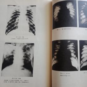 内科疾病签别诊断学内科疾病签别诊断学(内有毛主席语录和医学图片)