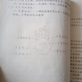 极少见！徐州市毛泽东思想统帅新医疗法学习班油印讲义一新医疗法讲义汇编！