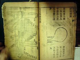 M2037，清早期精刻本医学古籍：针灸大成，存原装线装一厚册卷6，刻印精良，字体古朴 墨色浓，附铜人明堂全图版画多幅