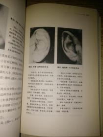 耳朵泄露的秘密