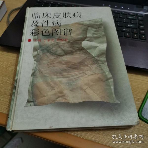 临床皮肤病及性病彩色图谱   精