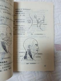针挑疗法原版一版一印