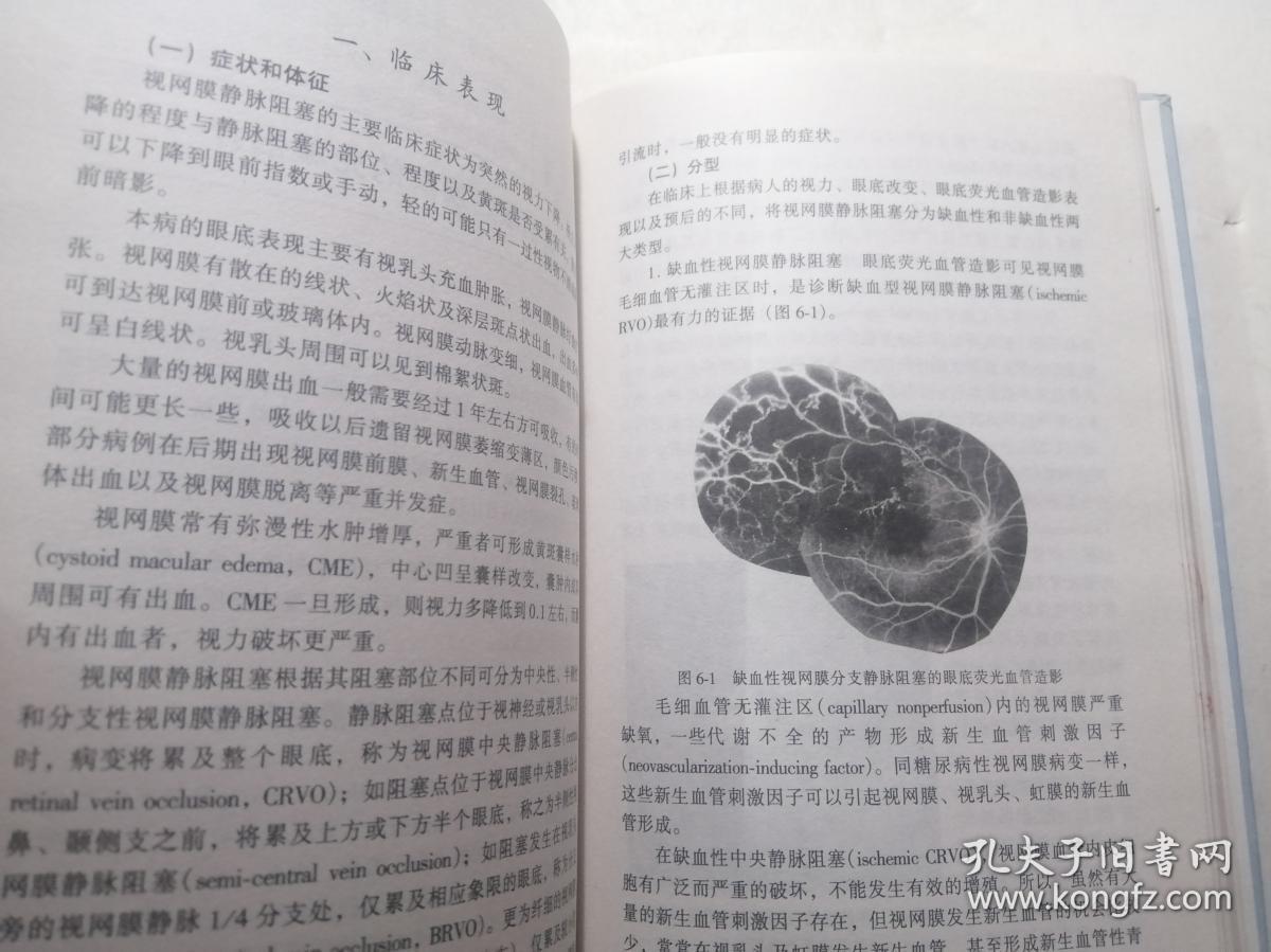 眼科激光治疗学概要