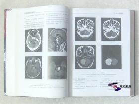 现代全身CT诊断学 (第3版)  【唐光健 签名本 私藏精装上下全02册整售 】