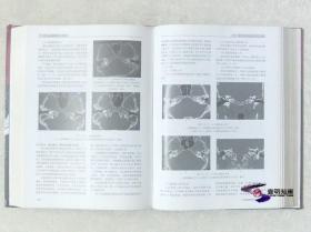 现代全身CT诊断学 (第3版)  【唐光健 签名本 私藏精装上下全02册整售 】