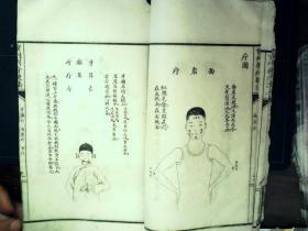Q1338，少见套印本医学古籍，民国白纸精美套印本：重刊刺疔捷法大全，大开本线装一厚册全，大量精美医学版画，手书上版，印刷精良，版本少见
