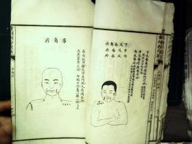 Q1338，少见套印本医学古籍，民国白纸精美套印本：重刊刺疔捷法大全，大开本线装一厚册全，大量精美医学版画，手书上版，印刷精良，版本少见