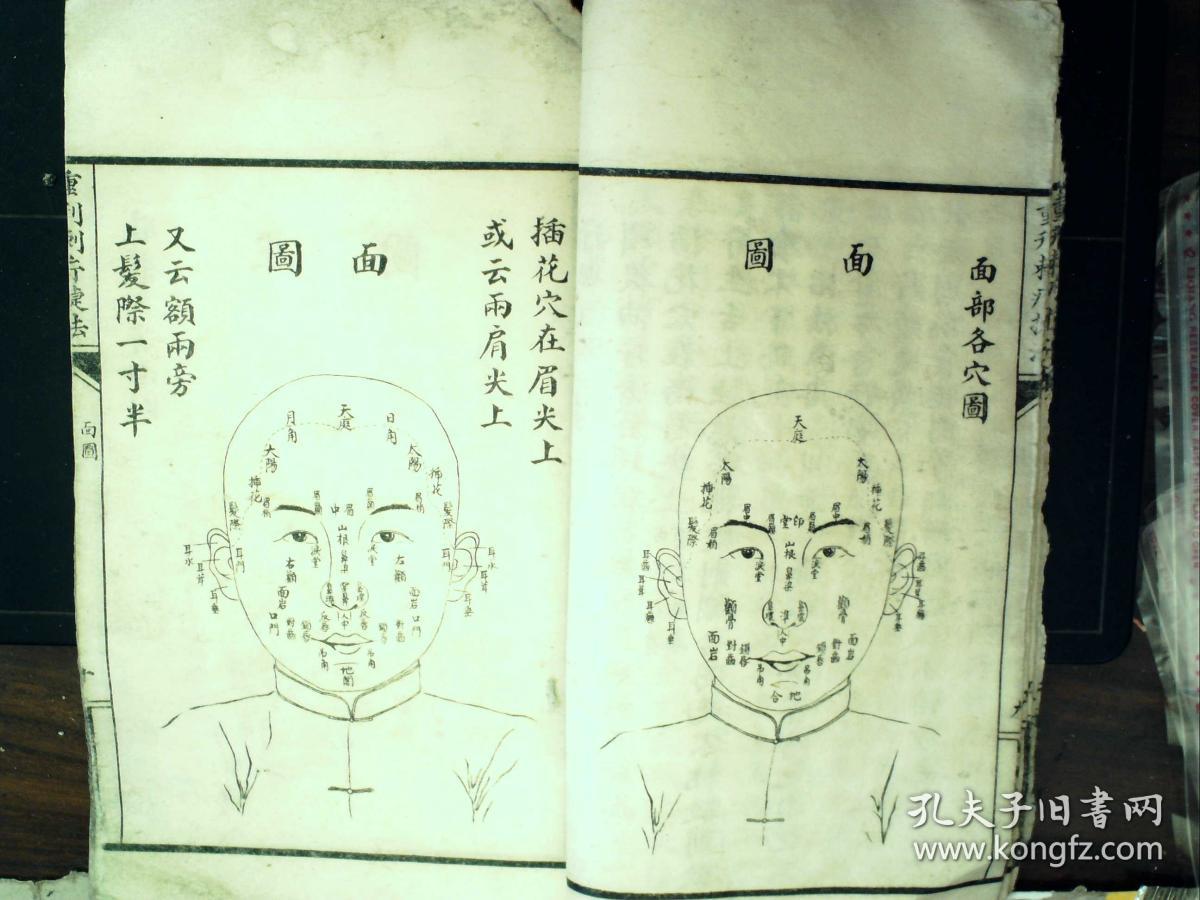 Q1338，少见套印本医学古籍，民国白纸精美套印本：重刊刺疔捷法大全，大开本线装一厚册全，大量精美医学版画，手书上版，印刷精良，版本少见