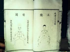 Q1338，少见套印本医学古籍，民国白纸精美套印本：重刊刺疔捷法大全，大开本线装一厚册全，大量精美医学版画，手书上版，印刷精良，版本少见