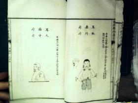 Q1338，少见套印本医学古籍，民国白纸精美套印本：重刊刺疔捷法大全，大开本线装一厚册全，大量精美医学版画，手书上版，印刷精良，版本少见