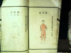 Q1338，少见套印本医学古籍，民国白纸精美套印本：重刊刺疔捷法大全，大开本线装一厚册全，大量精美医学版画，手书上版，印刷精良，版本少见