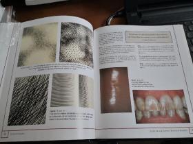 【英文原版，义齿制作，表面纹理，烤瓷牙类】  Surface textures -The Theory of Surface Marks