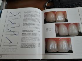 【英文原版，义齿制作，表面纹理，烤瓷牙类】  Surface textures -The Theory of Surface Marks