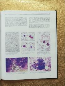 Chinical Haematology