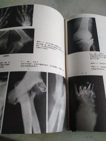 骨关节X线诊断学 精装