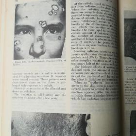 Andrews Diseases of the Skin: Clinical Dermatology 安德鲁斯临床皮肤病学